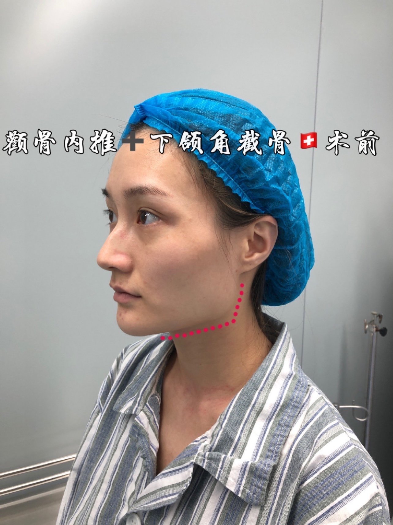 颧骨高脸瘦的女人面相_男人方脸颧骨高面相分析_额头窄颧骨高男人面相