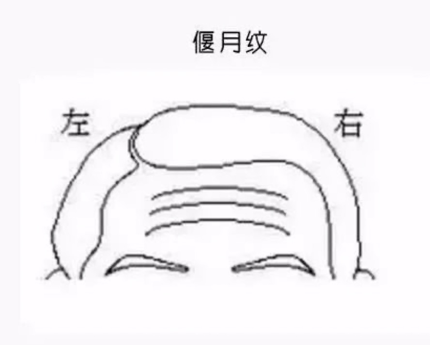 面相学中:悬针纹是很不好的面相特征，但凡是拥有