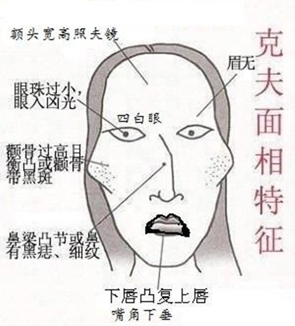 什么样的面相的女人最容易被“三白眼”