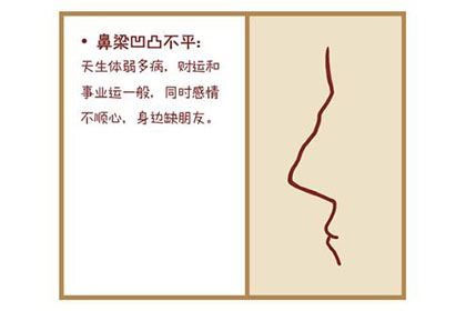 鼻梁有节的女人命运如何，可能会被老公抛弃！