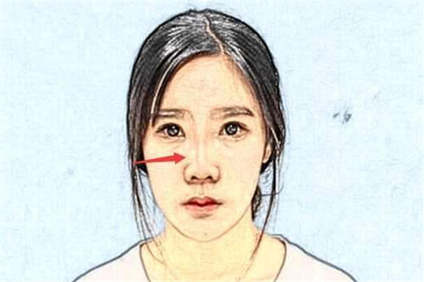 女人鼻子上长痣好不好，代表着什么含义