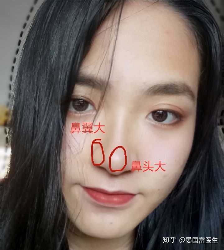 女人鼻子上长痣好不好，代表着什么含义