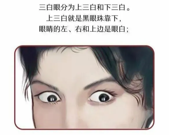 （李向东）四白眼的男人面相命运如何吧？！